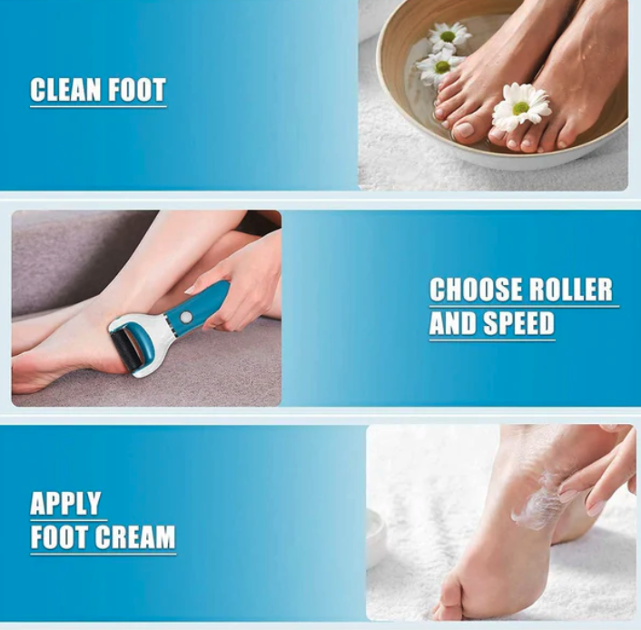 Lima Eléctrica Azul - Set de Manicura y Pedicura para Eliminar Durezas y Cuidado de Pies (Ref: 5057/100035) - Imagen 8